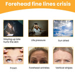 A grid of six images illustrating causes and types of forehead wrinkles like sun exposure and frown lines.