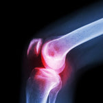 Ergonomic XL Knee Cap for Support, enhancing comfort and stability.